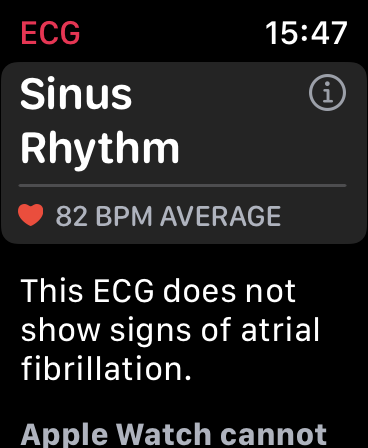 /wp-content/uploads/2021/09/ecg02.png /wp-content/uploads/2021/09/ecg02.png